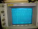Philips TX594U foto 34